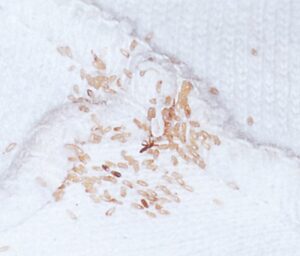 Æg af kropslus i en undertrøje