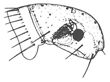 Menneskeloppe